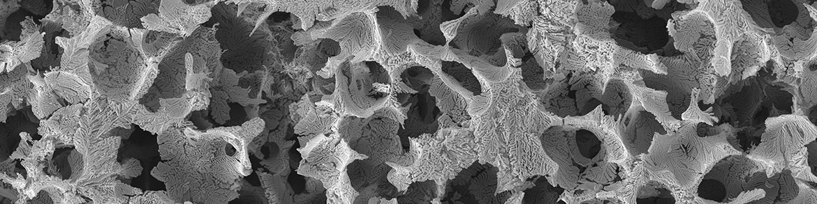 metallographie-tiefengeaetzt-AlSi REM Aufnahme