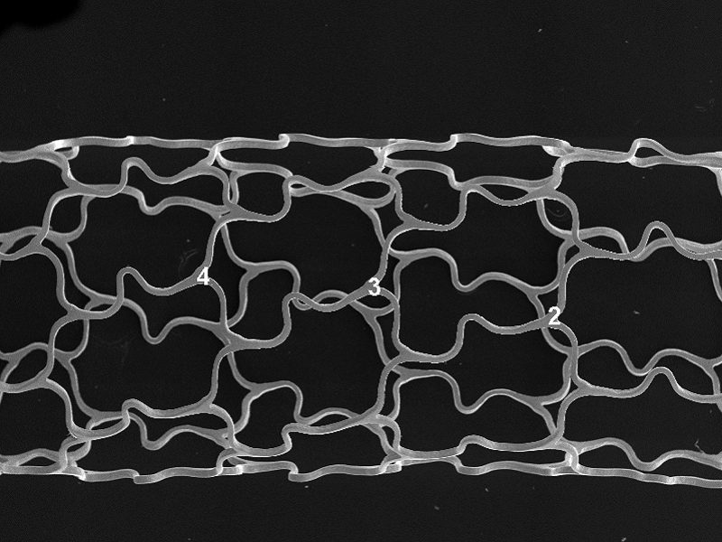 REM Aufnahme Stent Medizibtechnik Rasterelektronenmikroskop